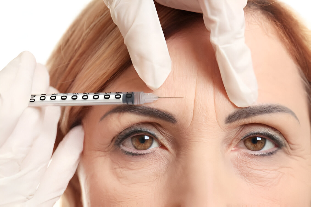 Botox_Injections