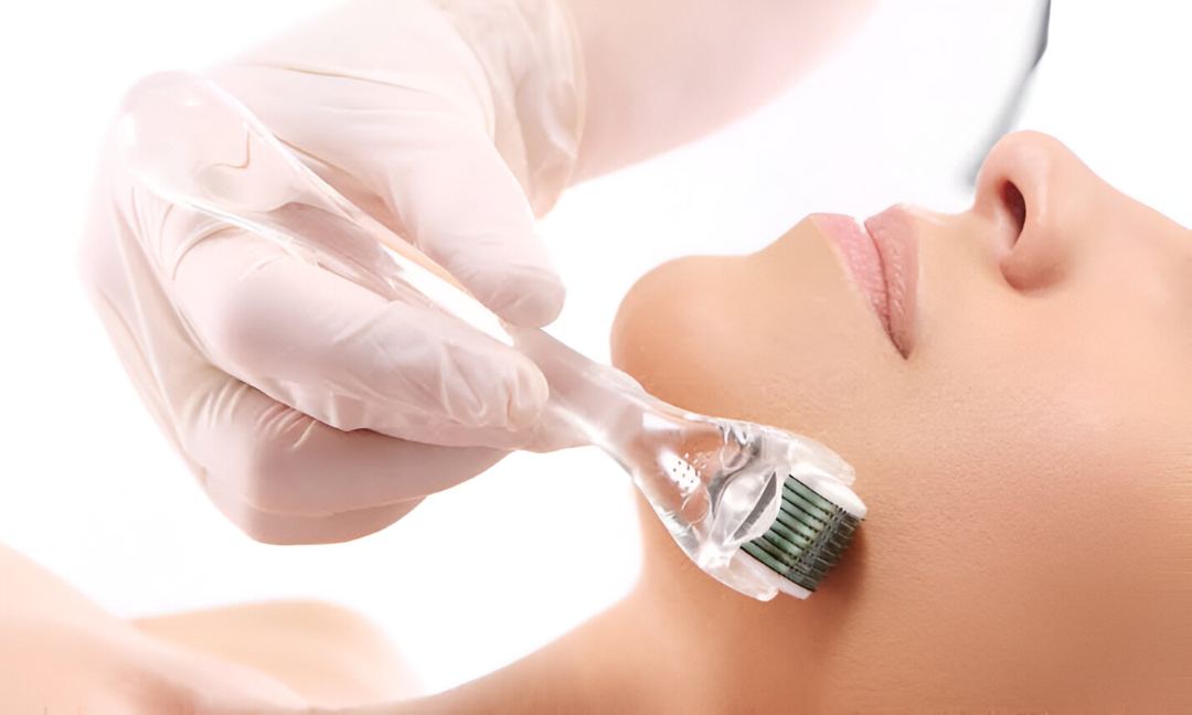 Derma_Roller