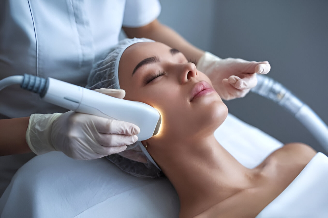 laser treatments