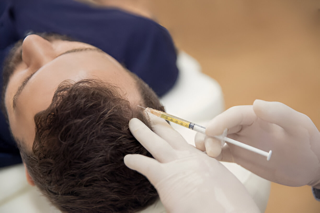 PRP_therapy