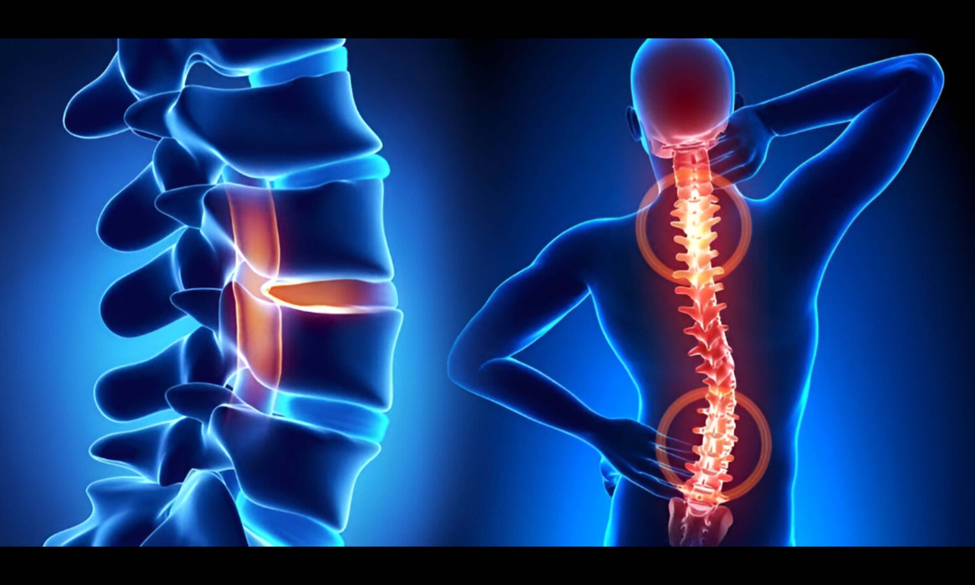 Spine_Related_Problems